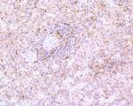 Caspase 3 Antibody in Immunohistochemistry (Paraffin) (IHC (P))