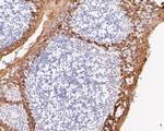 Cytokeratin 5/6 Antibody in Immunohistochemistry (Paraffin) (IHC (P))