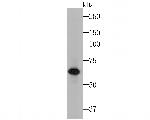 Cytokeratin 5/6 Antibody in Western Blot (WB)