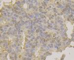 APE1 Antibody in Immunohistochemistry (Paraffin) (IHC (P))