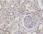 MSH2 Antibody in Immunohistochemistry (Paraffin) (IHC (P))