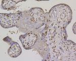 MSH2 Antibody in Immunohistochemistry (Paraffin) (IHC (P))