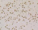 MSH2 Antibody in Immunohistochemistry (Paraffin) (IHC (P))