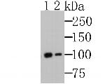 MSH2 Antibody in Western Blot (WB)