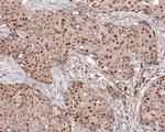 MSH2 Antibody in Immunohistochemistry (Paraffin) (IHC (P))