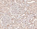 MSH2 Antibody in Immunohistochemistry (Paraffin) (IHC (P))