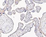 MSH2 Antibody in Immunohistochemistry (Paraffin) (IHC (P))