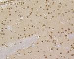 MSH2 Antibody in Immunohistochemistry (Paraffin) (IHC (P))