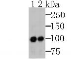 MSH2 Antibody in Western Blot (WB)