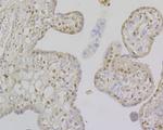 MSH2 Antibody in Immunohistochemistry (Paraffin) (IHC (P))