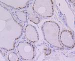 PAX8 Antibody in Immunohistochemistry (Paraffin) (IHC (P))