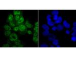 PTBP1 Antibody in Immunocytochemistry (ICC/IF)