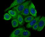 Calreticulin Antibody in Immunocytochemistry (ICC/IF)