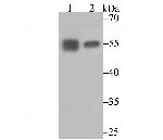 Calreticulin Antibody in Western Blot (WB)