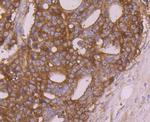 Calreticulin Antibody in Immunohistochemistry (Paraffin) (IHC (P))