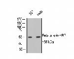 beta Tubulin Antibody in Immunohistochemistry (Paraffin) (IHC (P))