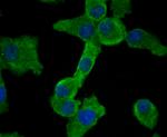 SMAD2 Antibody in Immunocytochemistry (ICC/IF)