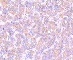 SMAD2 Antibody in Immunohistochemistry (Paraffin) (IHC (P))