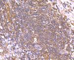 SMAD2 Antibody in Immunohistochemistry (Paraffin) (IHC (P))