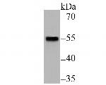 SMAD2 Antibody in Western Blot (WB)