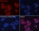 beta Tubulin Antibody in Immunocytochemistry (ICC/IF)