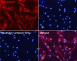 beta Tubulin Antibody in Immunocytochemistry (ICC/IF)