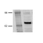 HSP70/HSC70 Antibody in Western Blot (WB)