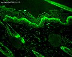 HSP27 Antibody in Immunohistochemistry (Paraffin) (IHC (P))