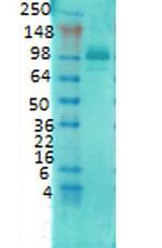 PSD-95 Antibody in Western Blot (WB)