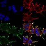 CRYAB Antibody in Immunocytochemistry (ICC/IF)