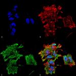 CRYAB Antibody in Immunocytochemistry (ICC/IF)