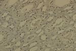 DNMT1 Antibody in Immunohistochemistry (IHC)