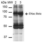 SCNN1B Antibody in Western Blot (WB)