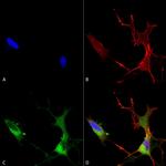 CaV1.2 Antibody in Immunocytochemistry (ICC/IF)