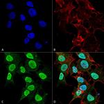 CaV1.2 Antibody in Immunocytochemistry (ICC/IF)