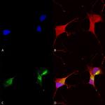 KCNQ1 Antibody in Immunocytochemistry (ICC/IF)