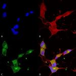 KCNQ4 Antibody in Immunocytochemistry (ICC/IF)