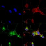 SCN9A Antibody in Immunocytochemistry (ICC/IF)