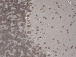 TRPM7 Antibody in Immunohistochemistry (PFA fixed) (IHC (PFA))