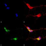 TRPV3 Antibody in Immunocytochemistry (ICC/IF)