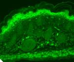 TRPV3 Antibody in Immunohistochemistry (Paraffin) (IHC (P))