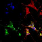 HCN4 Antibody in Immunocytochemistry (ICC/IF)