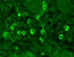 GABRA1 Antibody in Immunohistochemistry (Paraffin) (IHC (P))