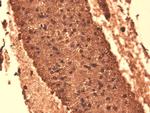 SLC5A5 Antibody in Immunohistochemistry (PFA fixed) (IHC (PFA))