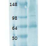 SLC5A5 Antibody in Western Blot (WB)