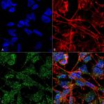 KCC2 Antibody in Immunocytochemistry (ICC/IF)