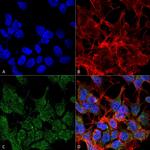 VGLUT2 Antibody in Immunocytochemistry (ICC/IF)