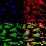 ATP7B Antibody in Immunocytochemistry (ICC/IF)