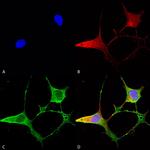 Ankyrin B Antibody in Immunocytochemistry (ICC/IF)