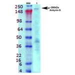 Ankyrin G Antibody in Western Blot (WB)